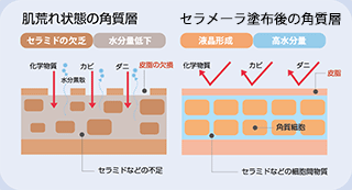 角質層の図