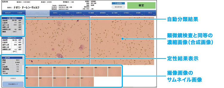 尿定性検査を含む結果と画像を同時表示する参照画面